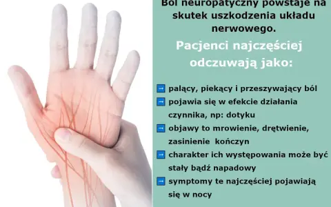 Dłoń z zaznaczonymi nerwami, ilustrująca ból neuropatyczny kręgosłupa. Odczuwany jako palący, piekący, z mrowieniem i drętwieniem.