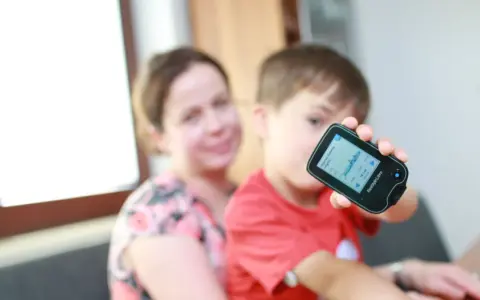 Chłopiec z mamą monitoruje poziom glukozy, co może być związane z objawami cukrzycy u dzieci.