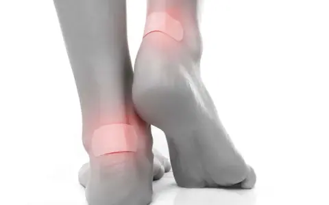 Pieds avec pansements sur les talons pour soulager une phlyctène douloureuse.