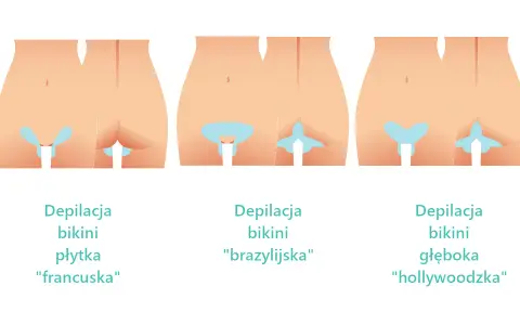 Jaki wosk do depilacji bikini, by uniknąć podrażnień i bólu?