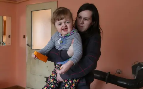 Matka trzyma dziecko z zespołem Aperta. Długość życia zależy od wielu czynników, ale miłość i wsparcie są kluczowe.