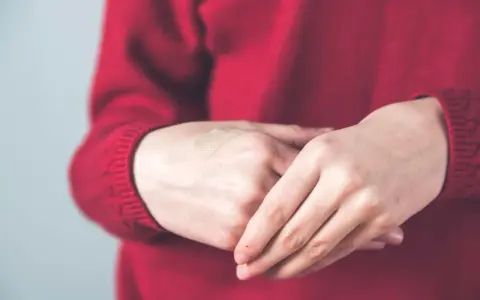 Pękające skórki? Odkryj brakujące witaminy i odzyskaj piękne dłonie!