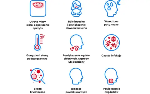Objawy białaczki limfatycznej: utrata masy, bóle brzucha, gorączka, powiększone węzły chłonne, bladość, skaza krwotoczna.