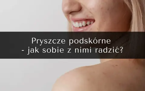 Uśmiechnięta twarz z piegami i pryszczami. Na ramionach widoczne są kolejne zmiany skórne. Tekst: "Pryszcze podskórne - jak sobie z nimi radzić?".
