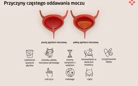 Ilustracja pokazuje pęcherz pusty i pełny, wyjaśniając przyczyny częstego sikania bez sikania.