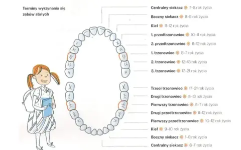 Schemat pokazuje nieprawidłowa kolejność wyrzynania się zębów stałych. Dziewczynka z plecakiem patrzy na diagram zębów.