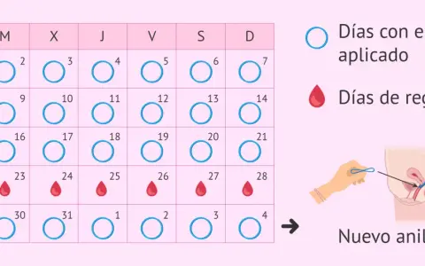 Calendario muestra días con anillo y días de regla. Se puede retirar la regla tomando anticonceptivos.
