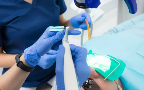 Ile kosztuje dentysta w Niemczech? Zaskakujące ceny i ubezpieczenie