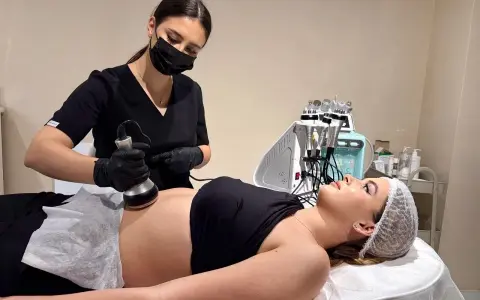 Liposukcja: Jak działa, ile kosztuje i czy jest dla Ciebie?