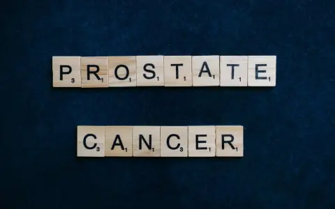 Litery z gry Scrabble układają napis "PROSTATE CANCER". Wiedza o objawach ostatniego stadium raka prostaty jest kluczowa.