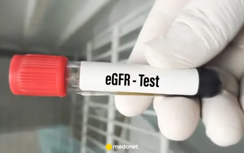 Rękawiczka trzyma probówkę z oznaczeniem "eGFR - Test". To ważny element badania gfr, oceniającego pracę nerek.