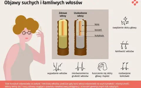 Ilustracja pokazuje objawy suchych i łamliwych włosów, w tym rozdwojone końcówki i ogólne osłabienie struktury włosa.