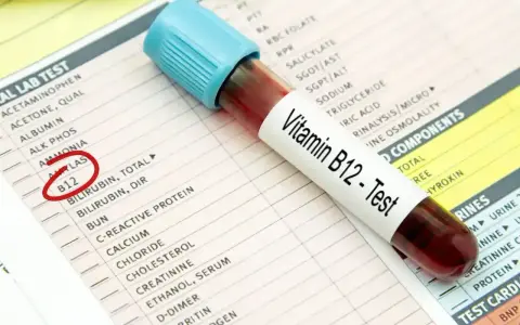 Próbówka z krwią do testu witaminy B12 leży na karcie wyników badań. Czerwone kółko zaznacza pozycję "B12", sugerując diagnostykę niedoboru B12 ICD 10.