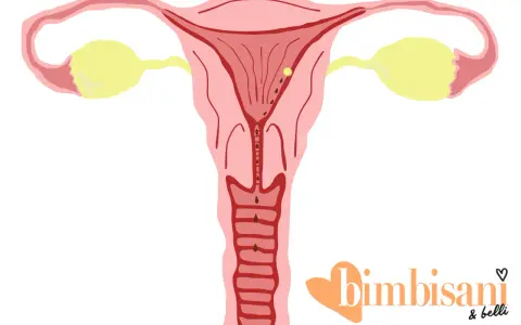 Illustrazione utero con ovuli gialli e macchie marroni, suggerendo spotting gravidanza colore.