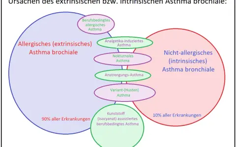 Schema zeigt extrinsisches Asthma, das 90% der Fälle ausmacht, mit Unterformen wie berufsbedingtem allergischem Asthma.
