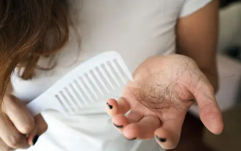 Frau hält Kamm und Haarbüschel in der Hand. Ein häufiges Problem: 4 Monate nach Geburt Haarausfall.