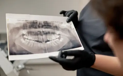 Pantomogram: Co dentysta widzi na zdjęciu? Ukryte problemy jamy ustnej