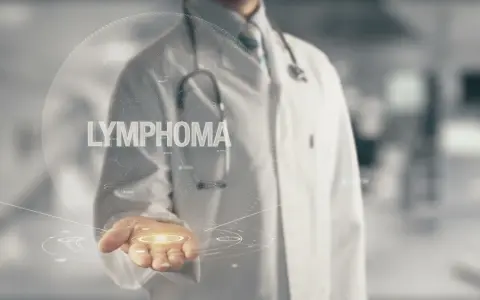 Lekarz prezentuje wirtualną kulę z napisem "LYMPHOMA", symbolizującą postęp w leczeniu chłoniaka grudkowego.