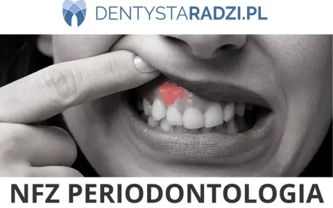 Zbliżenie na usta z widocznym zaczerwienieniem na dziąśle, sugerującym problem z paradontozą. Leczenie jest kluczowe.