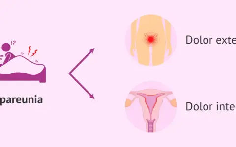 Dispareunia: dolor al ser penetrada, ya sea externo o interno.