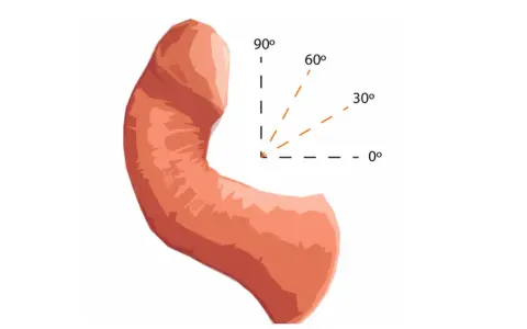 Ilustracja przedstawia prącie z zaznaczonymi kątami (0°, 30°, 60°, 90°), co może być związane z oceną uszkodzenia prącia objawy.
