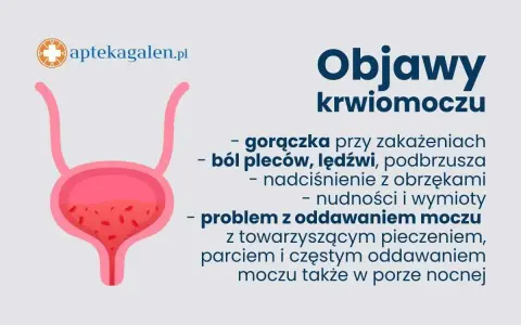 Grafika przedstawia pęcherz moczowy i objawy krwiomoczu: gorączkę, ból pleców, nudności, wymioty i problemy z oddawaniem moczu.