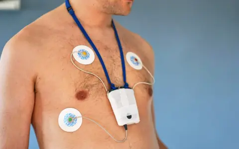 Mężczyzna z elektrodami EKG na klatce piersiowej i urządzeniem do badania holtera. Unikaj wysiłku fizycznego podczas badania holtera.