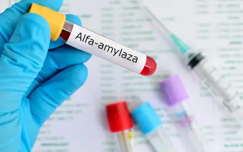 Amylaza podwyższona: co oznacza? Kiedy pilnie do lekarza?