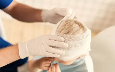 Manos enguantadas vendan la cabeza de un niño, curando sus heridas.