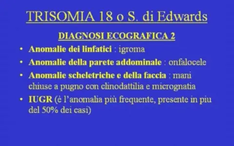 Diagnosi ecografica della trisomia 18: igroma, onfalocele, mani chiuse a pugno, micrognatia e IUGR.