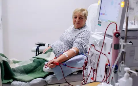Kobieta podłączona do dializy przez cewnik dializacyjny. Maszyna do dializy monitoruje jej stan.