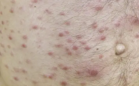 Blady jak ściana: co oznacza i jakie są jego przyczyny?