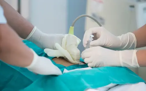Lekarze w rękawiczkach wykonują amniopunkcję, badanie płynu owodniowego, które odpowiada na pytanie: amniopunkcja co to.