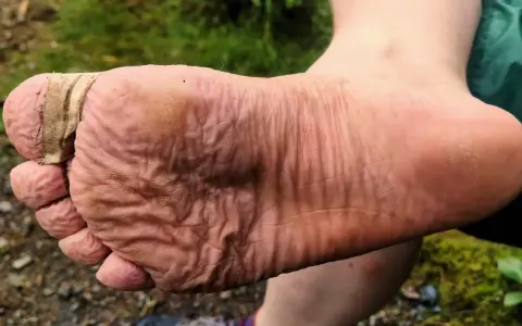 Fuß mit Blasenpflaster am Zeh, um Blasen vorzubeugen. Die Haut ist zerknittert vom Wandern.