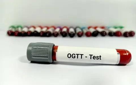 Probówka z oznaczeniem "OGTT - Test" na tle rzędu innych próbek. Wyniki tego testu pozwalają ocenić krzywą cukrową.