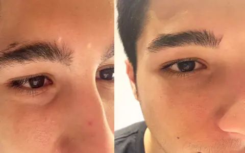 Antes y después de hacerse las cejas hombre. Las cejas se ven más definidas y limpias.