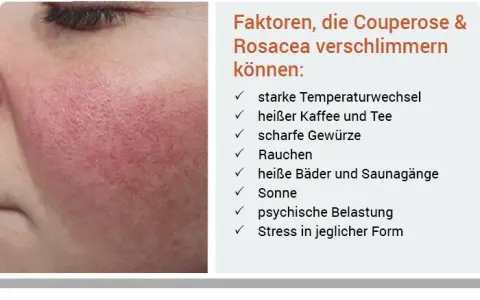 Rote Gesichtshaut: Ursachen, Symptome und wirksame Behandlungen