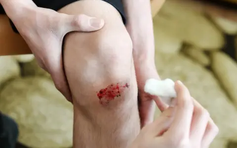 Une main tient un genou avec une **peau lésée** et sanglante, tandis qu'une autre main s'apprête à nettoyer la blessure avec du coton.