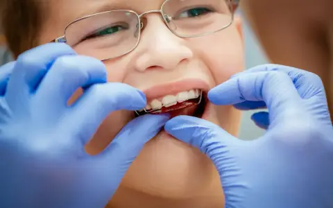 Chłopiec w okularach uśmiecha się, gdy dentysta w niebieskich rękawiczkach zakłada mu ruchomy aparat na zęby dla dzieci.