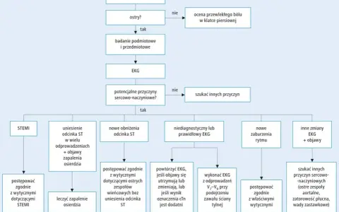 Algorytm diagnostyczny bólu w klatce piersiowej, uwzględniający nieleczona choroba wieńcowa.