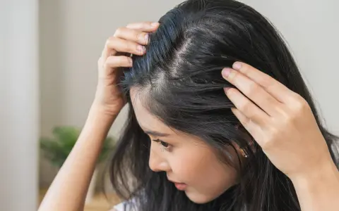 Kobieta dotyka swoich włosów, które wydają się przerzedzone. Widać delikatne baby hair przy skórze głowy.