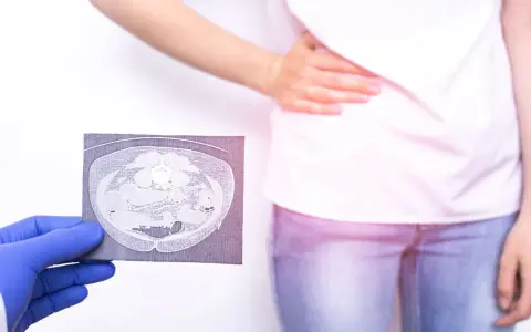 Lekarz w rękawiczce pokazuje tomografię jamy brzusznej osobie z bólem brzucha.