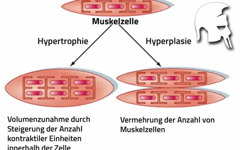 Sarkoplasmatische Hypertrophie: Muskelzelle wächst durch mehr kontraktile Einheiten. Daneben Hyperplasie: mehr Muskelzellen.