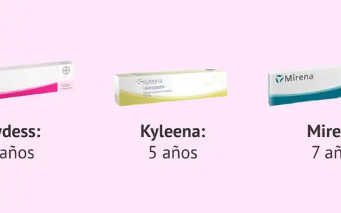 Jaydess, Kyleena y Mirena son métodos de planificación familiar, cada uno con una duración distinta. El diu hormonal ofrece diversas opciones.