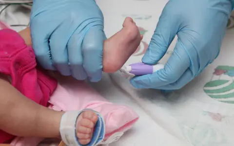 Screening neonatale dopo 15 giorni: un prelievo dal piedino per controlli essenziali.
