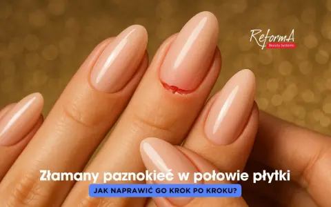 Złamany paznokieć w połowie płytki, z widocznym pęknięciem. Dłoń z zadbanymi paznokciami na złotym tle.