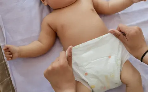 Rączki dziecka leżą na pieluszce, która jest zmieniana. Uważaj na grzybicę pieluszkową.