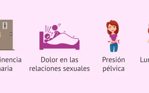 Ilustraciones de incontinencia, dolor en las relaciones sexuales, presión pélvica y lumbago, síntomas asociados al prolapso uterino.