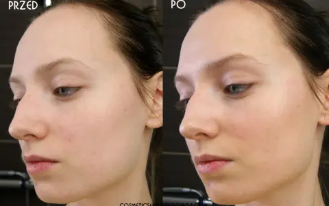 Dr Irena Eris VitaCeric: Rozświetlenie i rewitalizacja. Czy warto?