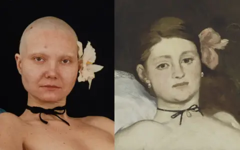 Dwie kobiety, jedna łysa z kwiatem we włosach, druga na obrazie inspirowanym Olimpia Manet.